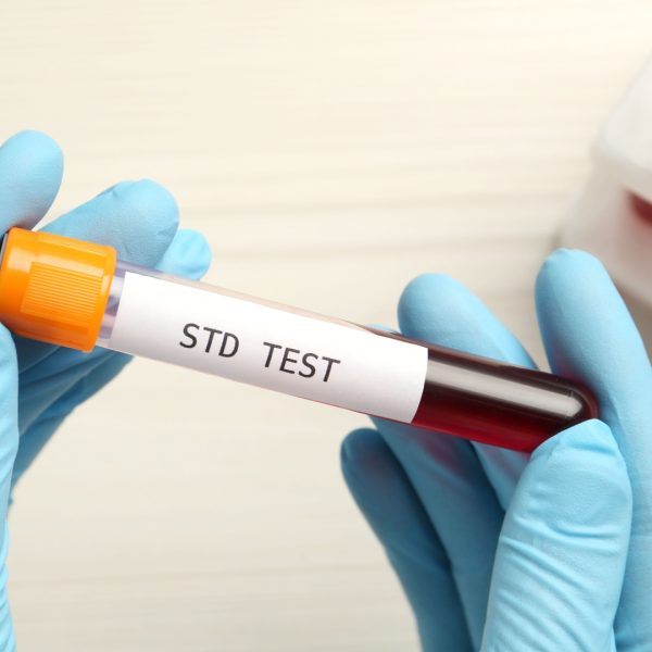 STD-Testing-Near-Me