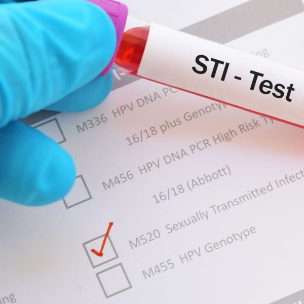 STI-Testing